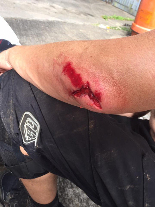 Bouncing Back: When Crashes Happen on the Trail